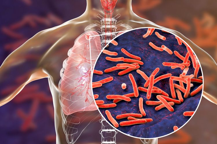 A Granular and Cost-Effective Mapping of Tuberculosis Susceptibility Risk Areas: Multisource Geospatial Big Data Approach